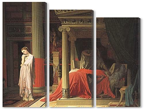 Модульная картина - Antiochus and Stratonice
